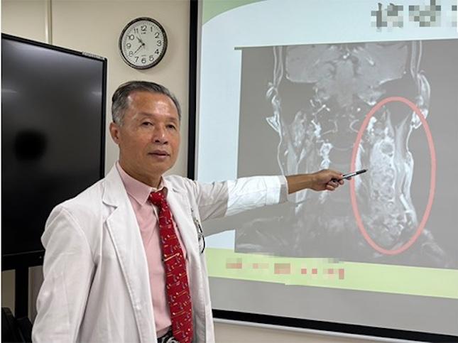 Nam giám đốc 60 tuổi sống rất lành mạnh vẫn mắc ung thư, bác sĩ thở dài: "3 thứ trên cổ ĐỪNG xem nhẹ"- Ảnh 1.