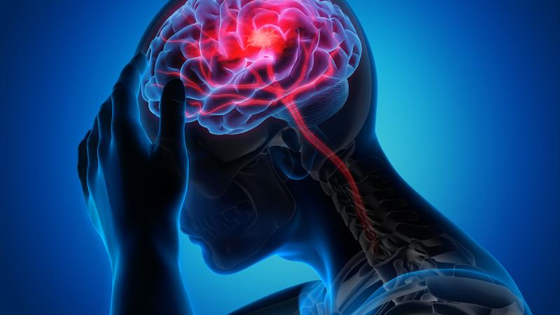 Người dễ bị đột quỵ thường có 10 đặc điểm này: Có 1 cũng cần hành động ngay- Ảnh 1.
