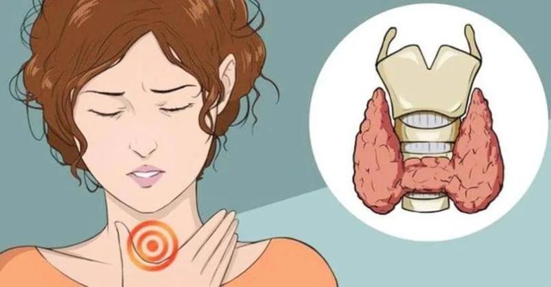 Nữ diễn viên 36 tuổi tiết lộ "mắc bệnh Hashimoto", phải từ bỏ đồ ăn ngoài để giữ sức khỏe: Căn bệnh thường gặp ở phụ nữ, không thể chữa khỏi - Ảnh 5.