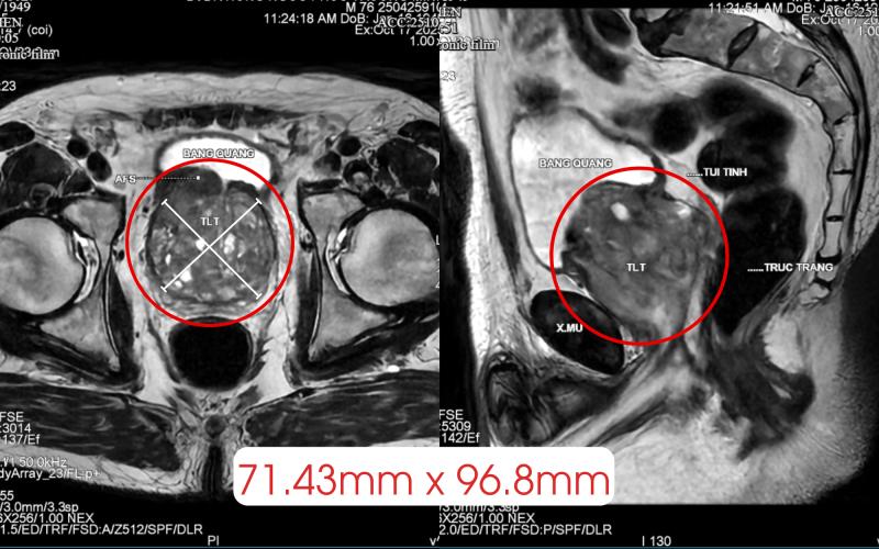 Khách Tây là nhạc sĩ sang 1 bệnh viện ở Việt Nam chữa đi tiểu 20 phút/lần: "Bây giờ tôi thấy mình đang ở trong 1 cơ thể mới" - Ảnh 1.