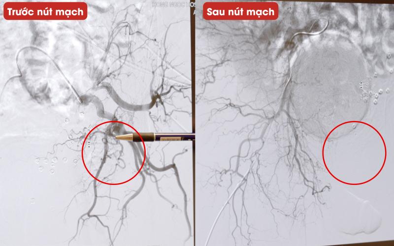 Khách Tây là nhạc sĩ sang 1 bệnh viện ở Việt Nam chữa đi tiểu 20 phút/lần: "Bây giờ tôi thấy mình đang ở trong 1 cơ thể mới" - Ảnh 3.