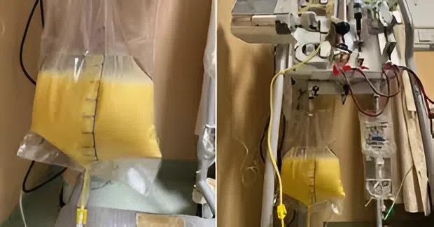 Người phụ nữ ra "máu trắng như sữa", bác sĩ lên tiếng cảnh báo- Ảnh 1.