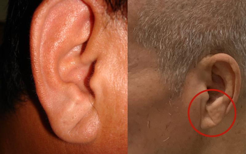 Các bác sĩ cảnh báo: Không cần chờ đến khi tức ngực, thấy 3 thứ này ở đầu và mặt tức là tim mạch đang "kêu cứu" - Ảnh 2.