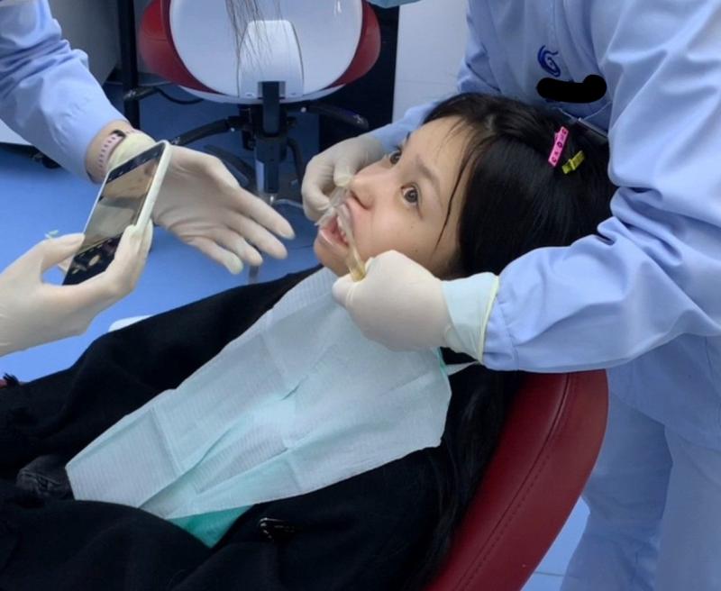 Chảy máu lợi khi đánh răng gây nguy hiểm cho não! Các bác sĩ cảnh báo: 2 vấn đề răng miệng tăng gấp đôi nguy cơ đột quỵ - Ảnh 3.