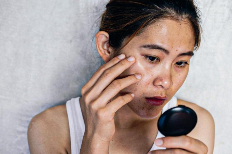 Nhìn mặt đoán bệnh gan, bác sĩ: Người bị bệnh gan có 5 điểm bất thường trên khuôn mặt- Ảnh 3.