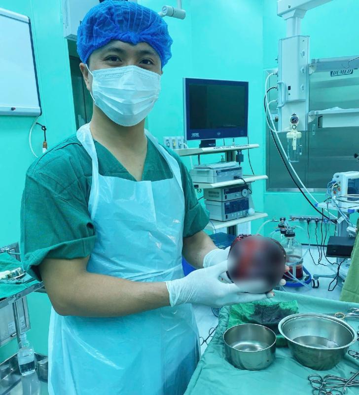 Đau bụng tưởng nhẹ, người đàn ông "sốc nặng" khi phát hiện thứ "đáng sợ" to bằng quả dưa lưới- Ảnh 1.