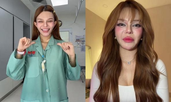 TikToker Đan Thy thông báo mắc ung thư máu ở tuổi 23: Ung thư máu có chữa được không?- Ảnh 1.