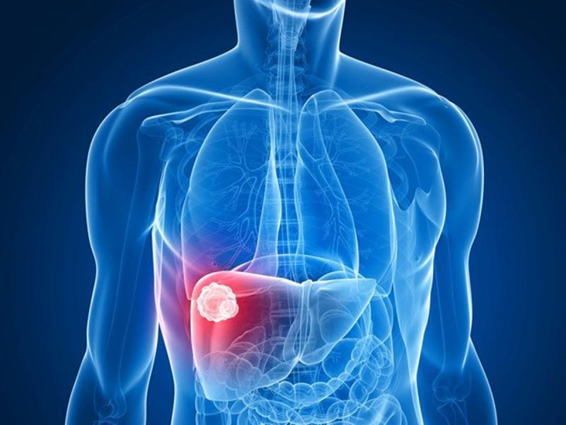 Luôn cảm thấy ngứa, cô gái trẻ "sốc" khi biết mình mắc căn bệnh này - Ảnh 1.