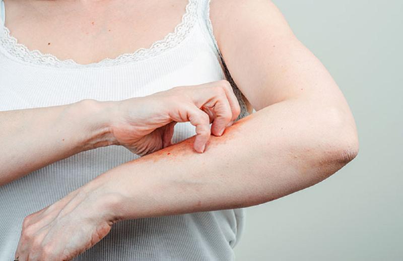 Luôn cảm thấy ngứa, người phụ nữ 59 tuổi "sốc" khi biết mình mắc liền 2 căn bệnh này - Ảnh 1.