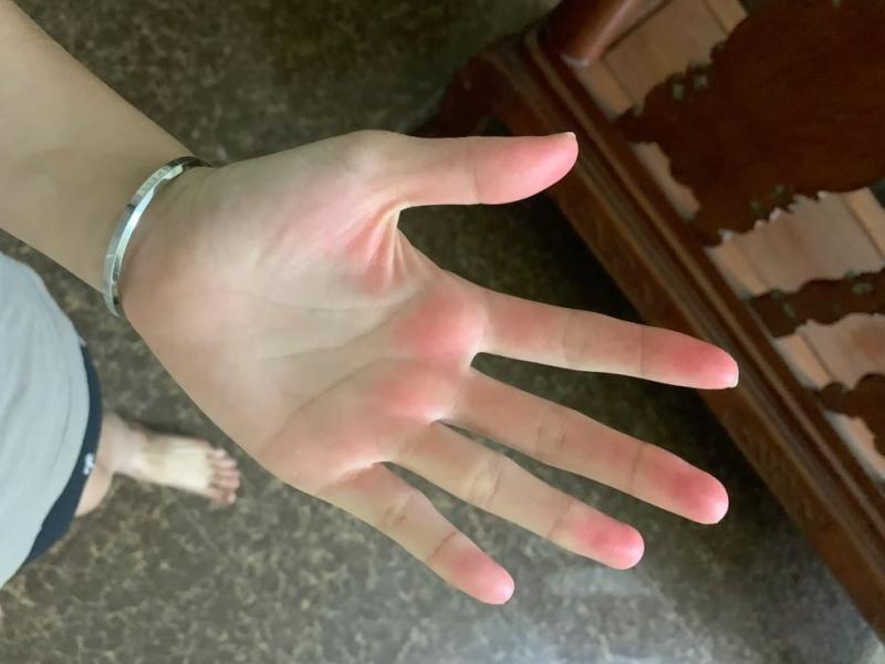 Nếu có đủ 5 thứ trên bàn tay thì xin chúc mừng! Gan của bạn khả năng cao vẫn còn rất khỏe - Ảnh 1.