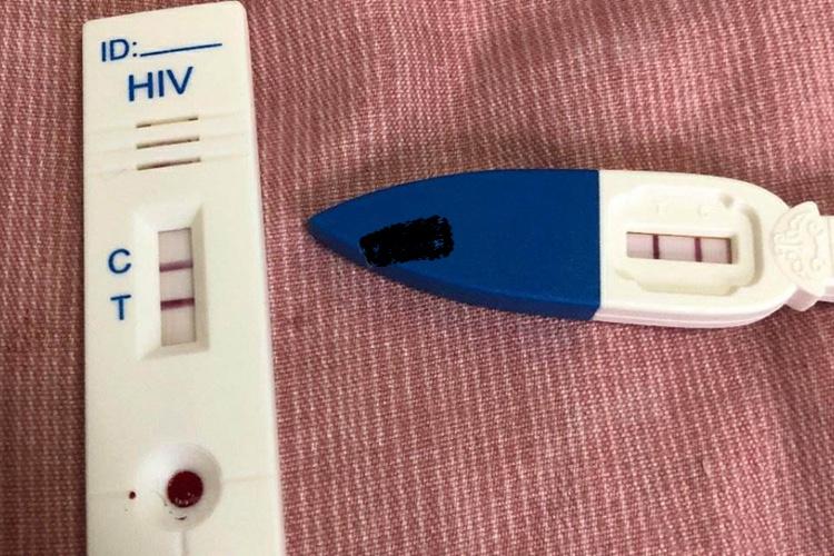 Người đàn ông 30 tuổi bất ngờ phát hiện nhiễm HIV khi đi khám mắt, bác sĩ: Đừng xem nhẹ 4 điều! - Ảnh 2.