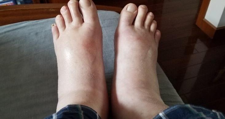 Người đàn ông 41 tuổi bị suy thận sau một lần… cảm lạnh - Ảnh 1.