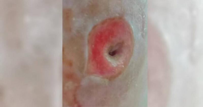 Người phụ nữ 40 tuổi chết lặng khi thấy mặt như "tổ ong" vì sai lầm ai cũng dễ mắc- Ảnh 1.