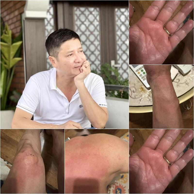 NSƯT Chí Trung mắc bệnh lạ- Ảnh 1.