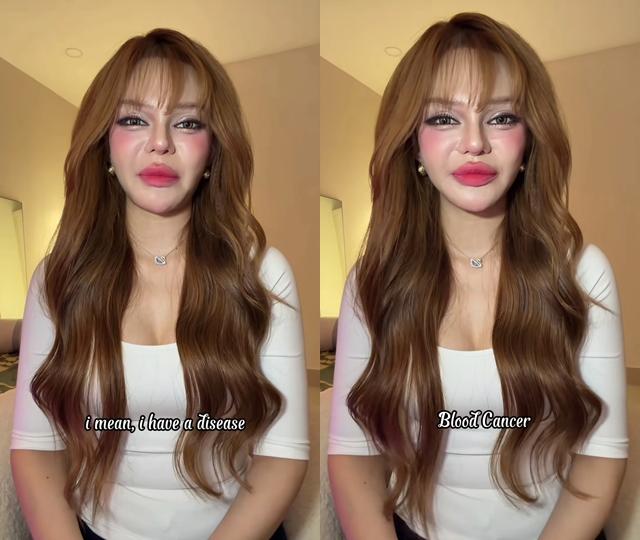 TikToker Đan Thy thông báo mắc ung thư máu ở tuổi 23: Ung thư máu có chữa được không?- Ảnh 4.