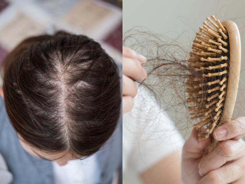Đừng chỉ ăn trứng luộc để ngừa tóc rụng! "Nữ thần không tuổi" Thái Y Lâm luôn làm việc này trước 21h30 cho da đẹp tóc khỏe, bác sĩ cũng phải khen - Ảnh 1.