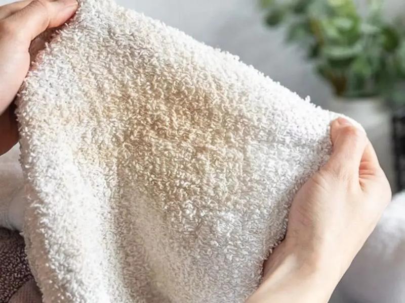 Bác sĩ da liễu cảnh báo đến tất cả những người đang dùng khăn mặt! - Ảnh 1.