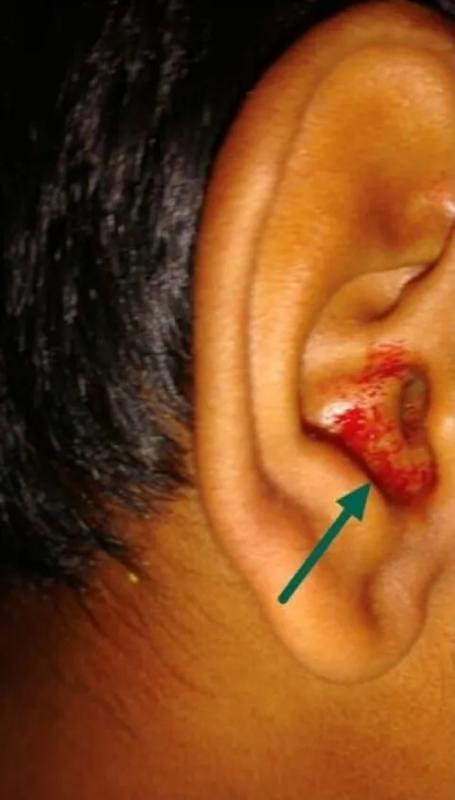 Bé trai 11 tuổi khóc ra máu khiến bác sĩ kinh ngạc - Ảnh 2.