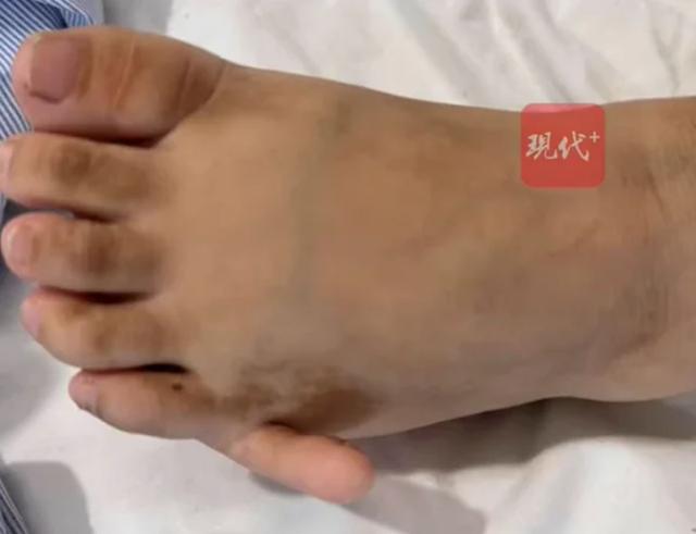 Cô gái 17 tuổi có 6 ngón tay "mọc" ra và sự thật bất ngờ- Ảnh 1.