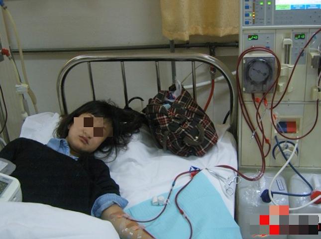 Cô gái 23 tuổi suy thận cấp suýt chết vì thói quen nhiều người Việt thích mê mỗi mùa nắng nóng - Ảnh 2.