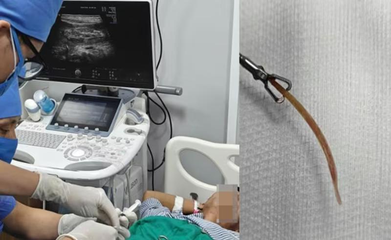 Đau bụng nhiều ngày tưởng nhẹ, đi khám người đàn ông "sốc" nặng khi biết bí mật - Ảnh 1.