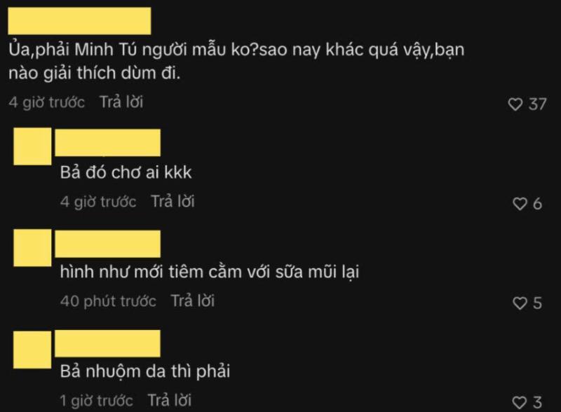 Siêu mẫu Minh Tú phẫu thuật thẩm mỹ?- Ảnh 1.