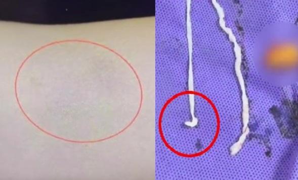 Người phụ nữ đau tay đi khám, bác sĩ kinh ngạc khi thấy thứ bên trong - Ảnh 1.