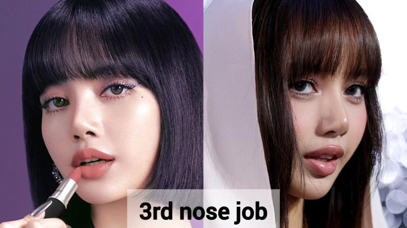 Nhận không ra mỹ nhân đẹp nhất thế giới: Nhan sắc thay đổi chóng mặt, vì 1 chiếc mũi mà nổi tiếng toàn cầu- Ảnh 5.