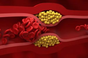 Không cần thực phẩm đắt tiền, bác sĩ chỉ 4 món quen thuộc giúp giảm cholesterol “cực đỉnh”