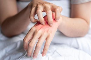 Nếu không thấy 5 thứ này trên bàn tay, XIN CHÚC MỪNG vì bạn có lá gan khỏe hơn người khác!