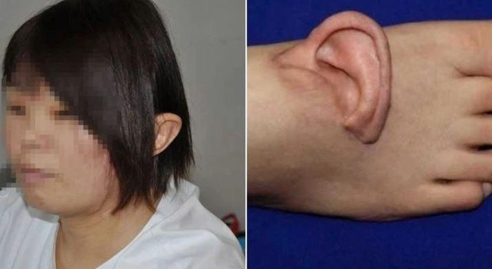 Người phụ nữ "mọc" tai trên bàn chân và sự thật bất ngờ - Ảnh 1.