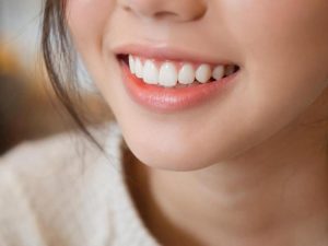 Thăng hạng visual từ nụ cười: Tọa độ "chữa lành" cho team sợ nha khoa