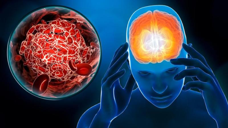 Giới siêu giàu châu Á và "cuộc chiến" chi hàng trăm triệu đồng mỗi năm để săn tìm một cục máu đông chưa kịp hình thành- Ảnh 4.
