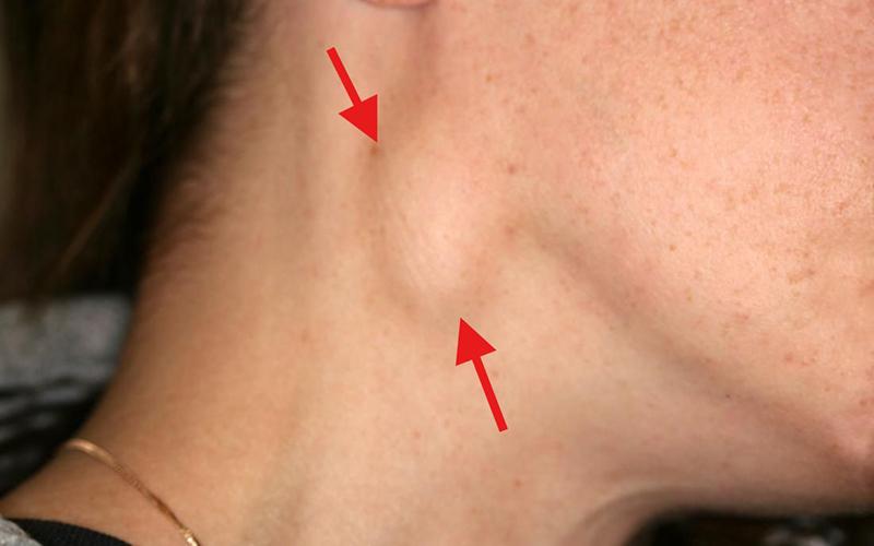 Chồng tháo mặt nạ oxy để hôn vợ lần cuối đăng tâm thư nghẹn lòng: Người vợ qua đời đã 1 tuần vì bệnh ung thư hạch- Ảnh 3. Chồng tháo mặt nạ oxy để hôn vợ lần cuối đăng tâm thư nghẹn lòng: Người vợ qua đời đã 1 tuần vì bệnh ung thư hạch- Ảnh 3.