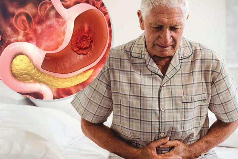 Ung thư dạ dày thường "để ý" tới những người có 5 thói quen này: Có 1 cũng phải bỏ ngay- Ảnh 2.