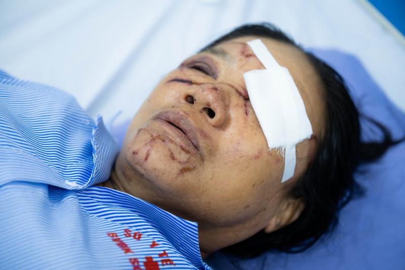 Gặp người phụ nữ bán rau bị xịt nước chảy máu mắt ở Phú Thọ: "Nước xối vào mạnh lắm, đau rát, tối mắt tối mũi"- Ảnh 2. Gặp người phụ nữ bán rau bị xịt nước chảy máu mắt ở Phú Thọ: "Nước xối vào mạnh lắm, đau rát, tối mắt tối mũi"- Ảnh 2.