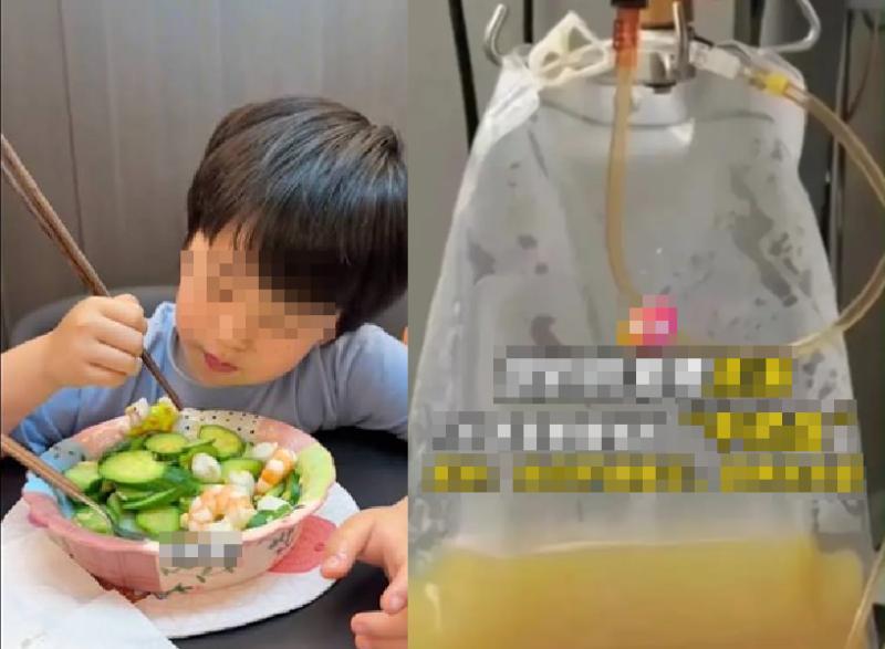 Cậu bé 5 tuổi máu "trắng đục như sữa" vì một món canh nhiều gia đình cho con nhỏ uống mỗi ngày - Ảnh 1.