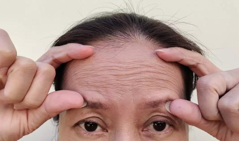 Bác sĩ nói thẳng: 7 đặc điểm trên mặt là dấu hiệu bệnh tật, ung thư, thật tệ khi nhiều người tưởng "điềm lành" - Ảnh 2.