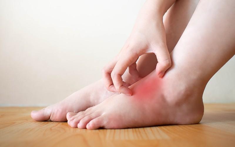 Cảnh báo đến những người thường ngứa 3 nơi trên cơ thể: Máu đã "ngập đường" - Ảnh 2.