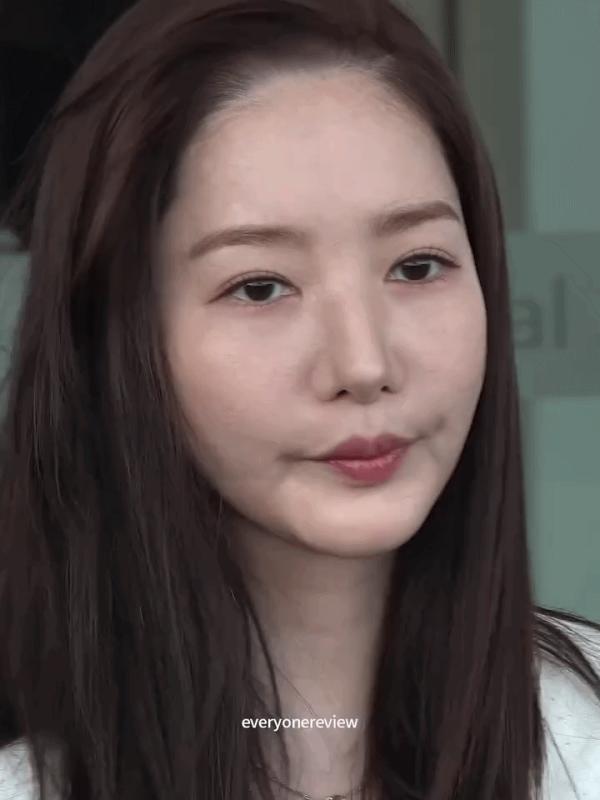 Park Min Young đã làm gì với gương mặt của mình vậy?- Ảnh 4.
