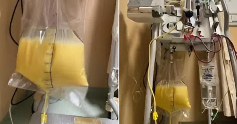 Người phụ nữ 32 tuổi "máu trắng đục như sữa" vì thứ quen thuộc trong tủ thuốc - Ảnh 1.