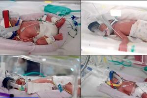 Ca sinh 4 cùng trứng cực hiếm, tỷ lệ chỉ 1/15 triệu ca mang thai