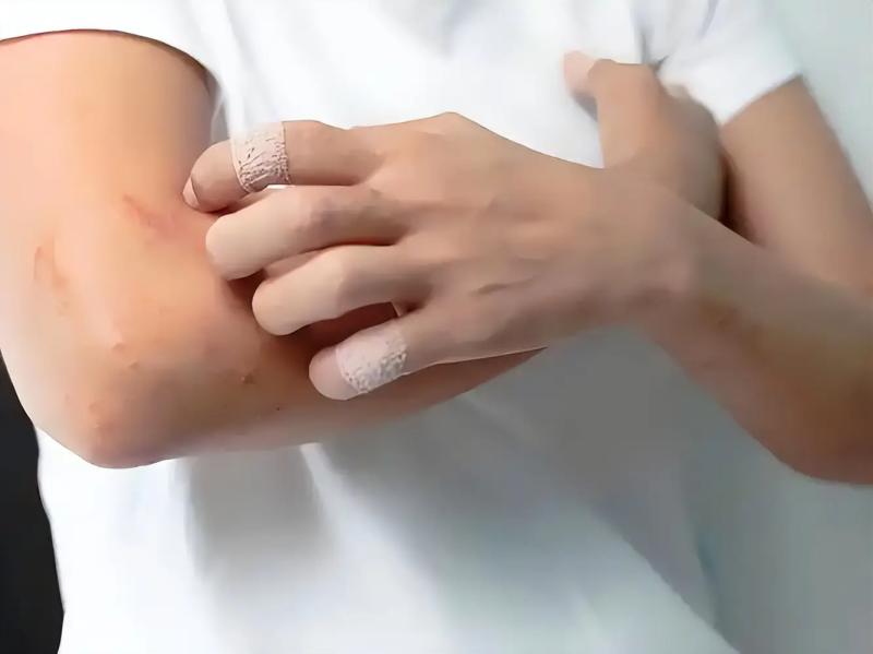Dấu hiệu nguy hiểm nhất của bệnh tiểu đường không phải là khát nước, mà là sự xuất hiện thường xuyên của 10 bất thường này- Ảnh 2.