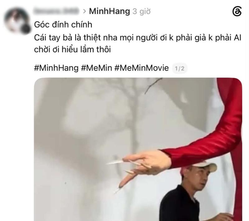 Ngón tay biến dạng của Minh Hằng- Ảnh 6.