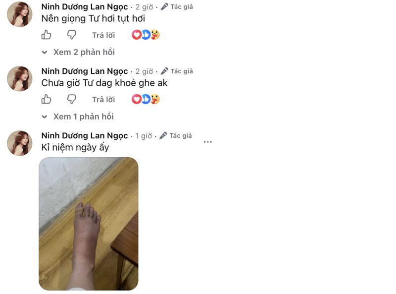 Ninh Dương Lan Ngọc mắc cúm B, chân sưng to gây lo lắng- Ảnh 2.