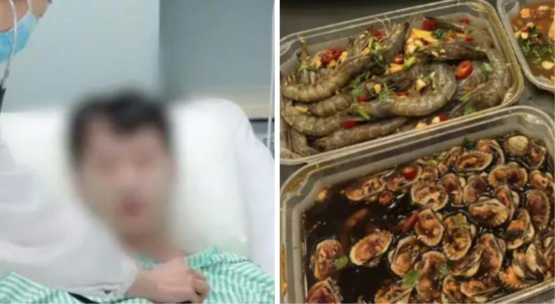 Người đàn ông bị loét ruột, chảy máu ồ ạt sau khi ăn hải sản: “Tôi vẫn còn rất may mắn…” - Ảnh 3.