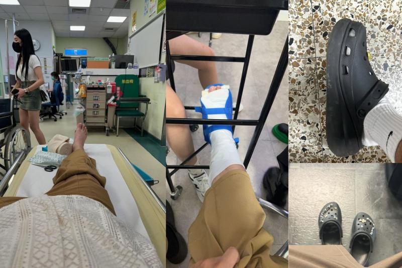 Lời khuyên cho những người thích đi dép sục, dép "kiểu crocs"- Ảnh 1.