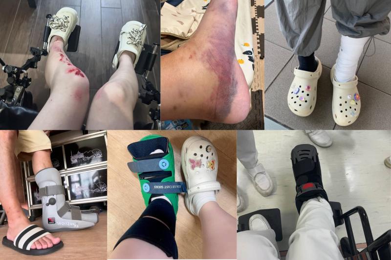 Lời khuyên cho những người thích đi dép sục, dép "kiểu crocs"- Ảnh 3.