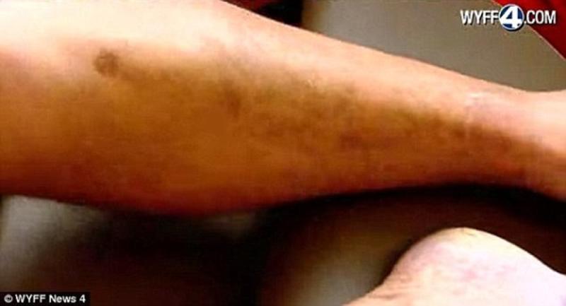 11 lần bị sét đánh vẫn sống, người đàn ông khiến cả thế giới kinh ngạc - Ảnh 2.