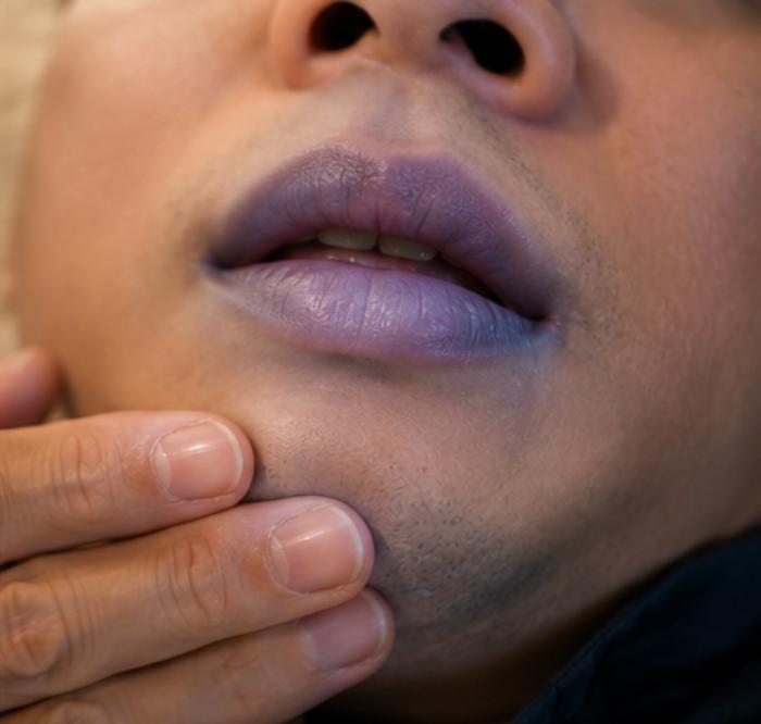 "Tôi chỉ hơi mệt sau khi uống": 5 dấu hiệu sau cuộc nhậu không nên coi là say bình thường, cần đi viện ngay- Ảnh 3.